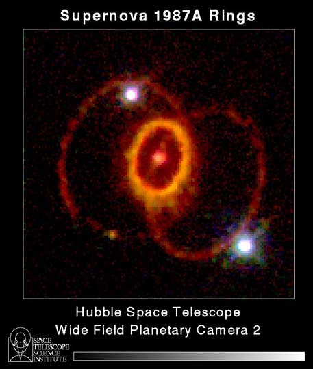 SN1987A Rings